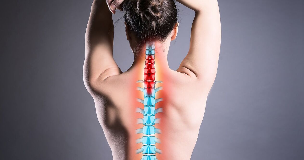 Spinal osteokondroz türleri